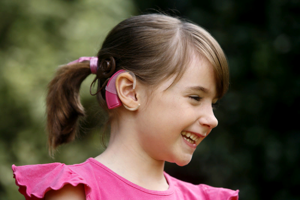 Кохлеарная имплантация Cochlear. Слуховой аппарат для детей. Ребенок с ки. Дети с нарушением слуха..